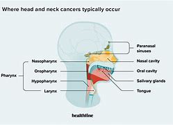 Image result for Head and Neck Cancer Regions