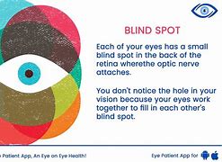 Image result for Blind Spots in Vision Look Like