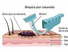 Image result for biopxia