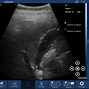 Image result for Portable Ultrasound Phone Scanner Android