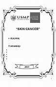 Image result for Wart Like Skin Cancer