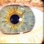 Image result for Iridology Yellow Ring around Pupil