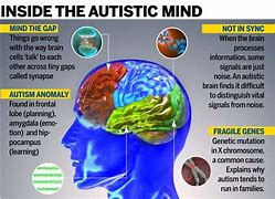 Image result for Autistic Brain