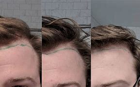 Image result for One Minor Hairline Crack