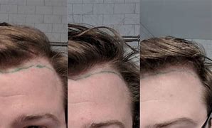 Image result for Hairline Crack Rate