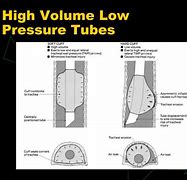Image result for High Pressure Low Volume