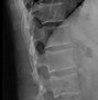 Image result for Vertebrae Lateral View