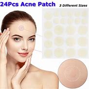 Image result for Stickers for Acne