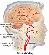 Image result for Carotid Artery Have Baroreceptors
