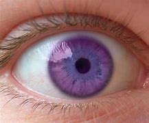 Image result for Personnatural Purple Eyes
