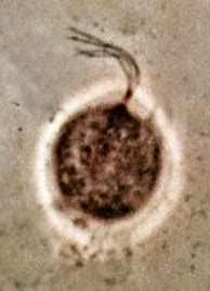 Image result for Trichomonas Vaginalis Gram