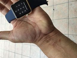 Image result for Swatch Watch Allergy