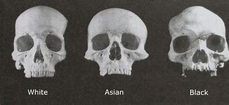 Image result for Skull Shape and Race