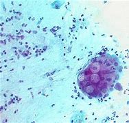 Image result for Chlamydia Trachomatis Under Microscope