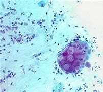 Image result for Chlamydia Microscopy