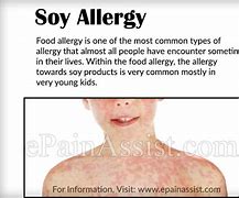 Image result for Soy Allergy Baby