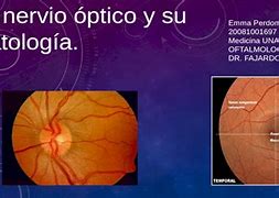 Image result for Nervio Optico
