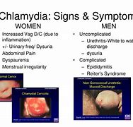 Image result for STD Signs and Symptoms
