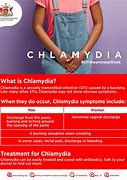 Image result for Chlamydia Infection
