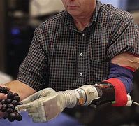 Image result for Utah Hand Robotic