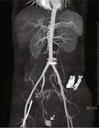 Image result for Contrast Angiography