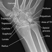 Image result for Bones On Wrist