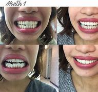 Image result for Philippines Sharp Teeth