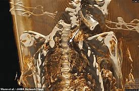 Image result for Ferentillo Mummie