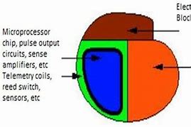 Image result for Hamilton Pacer Battery Size Chart