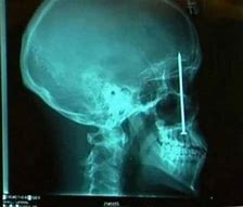 Image result for Amazing X-rays
