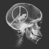 Image result for Funny X-ray Memes