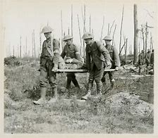 Image result for WW1 Wounded Soldiers