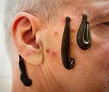Image result for Trypophobia Ear