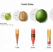 Image result for 6 mm Size of Tumor