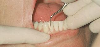 Image result for Teeth. File Betwen