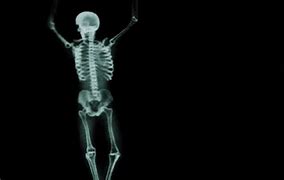 Image result for iPhone X-ray Looks Like