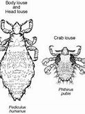 Image result for What Does Lice Look Like