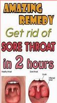 Image result for How to Get Rid of Severe Sore Throat