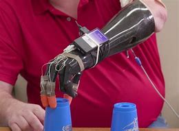 Image result for Robotic Hand Brace