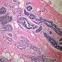 Image result for Histopathology