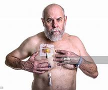 Image result for IV Chemotherapy