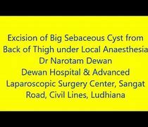 Image result for How Big Is 4Mm Cyst