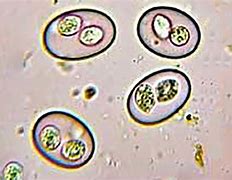 Image result for Coccidia