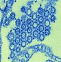 Image result for Chlamydia Structure