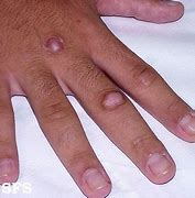 Image result for Two Finger Knuckles