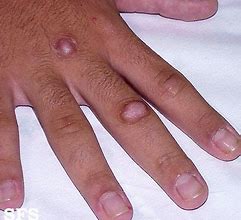 Image result for Conditioned Knuckles