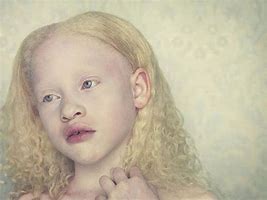 Image result for albinisko