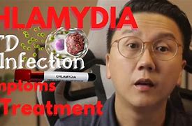 Image result for Chlamydia in Your Throat