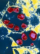 Image result for Chlamydia Bacteria