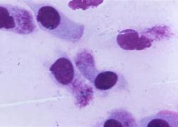 Image result for Chlamydia Gram Stain